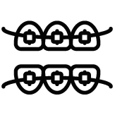 ortodoncia convencional | clinica dental mataro