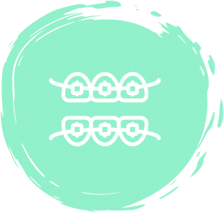 ortodoncia convencional | clinica dental mataro