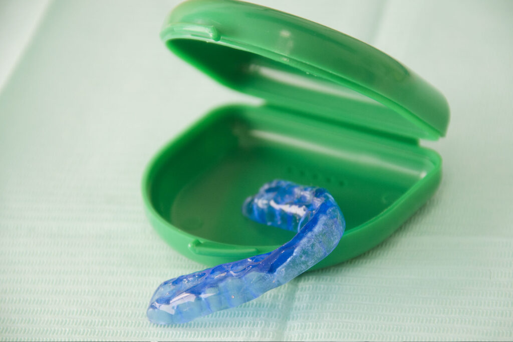 bruxisme | clinica dental mataro