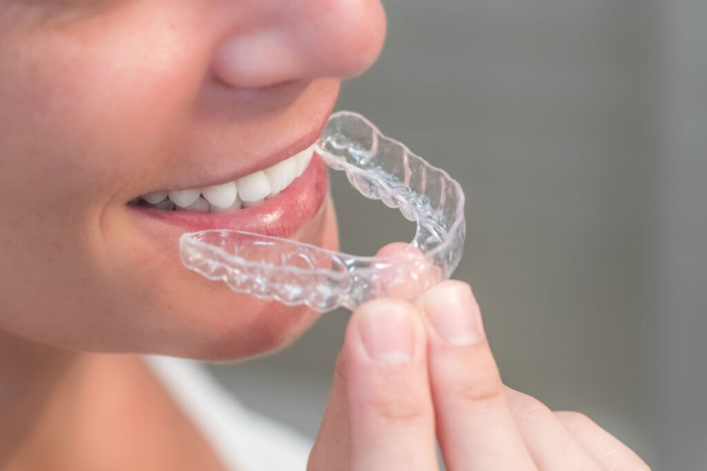 ortodoncia invisible | clinica dental a mataro