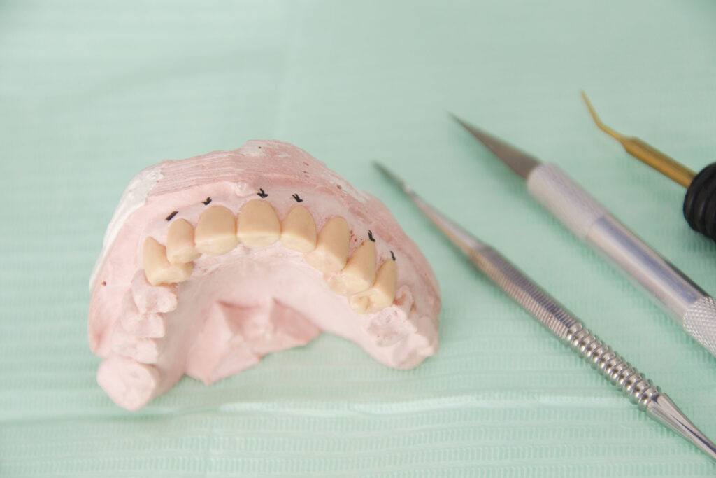 protesis | clinica dental a mataro