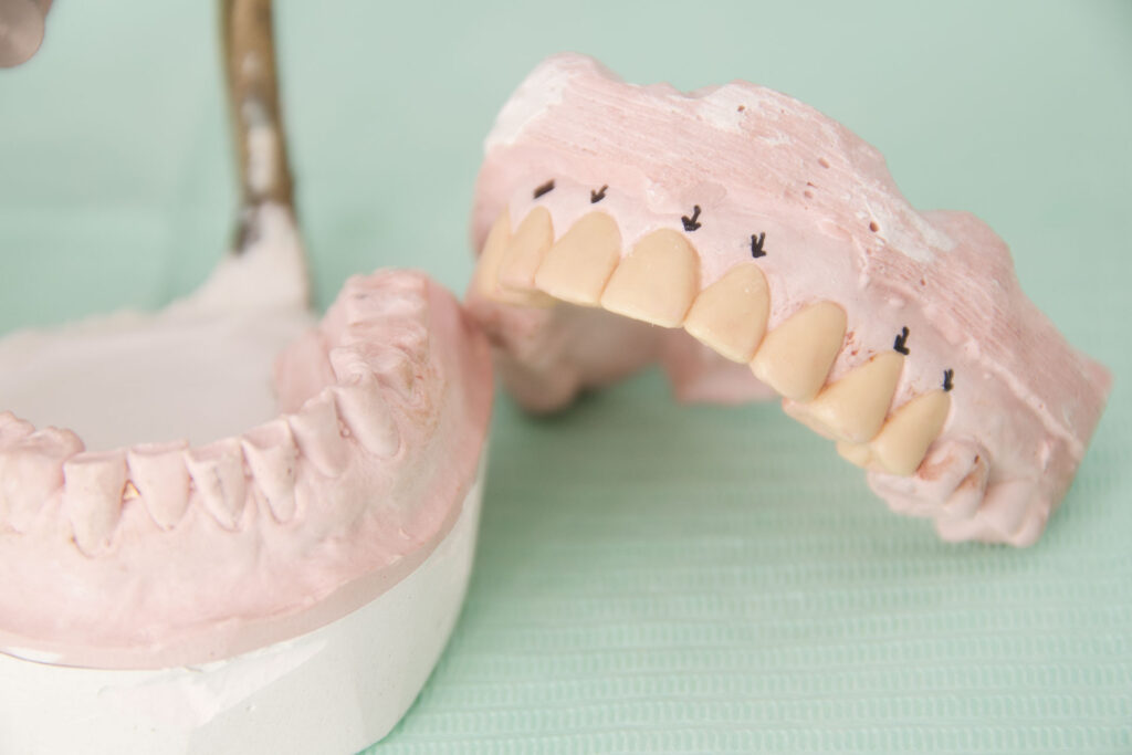 protesis | clinica dental a mataro