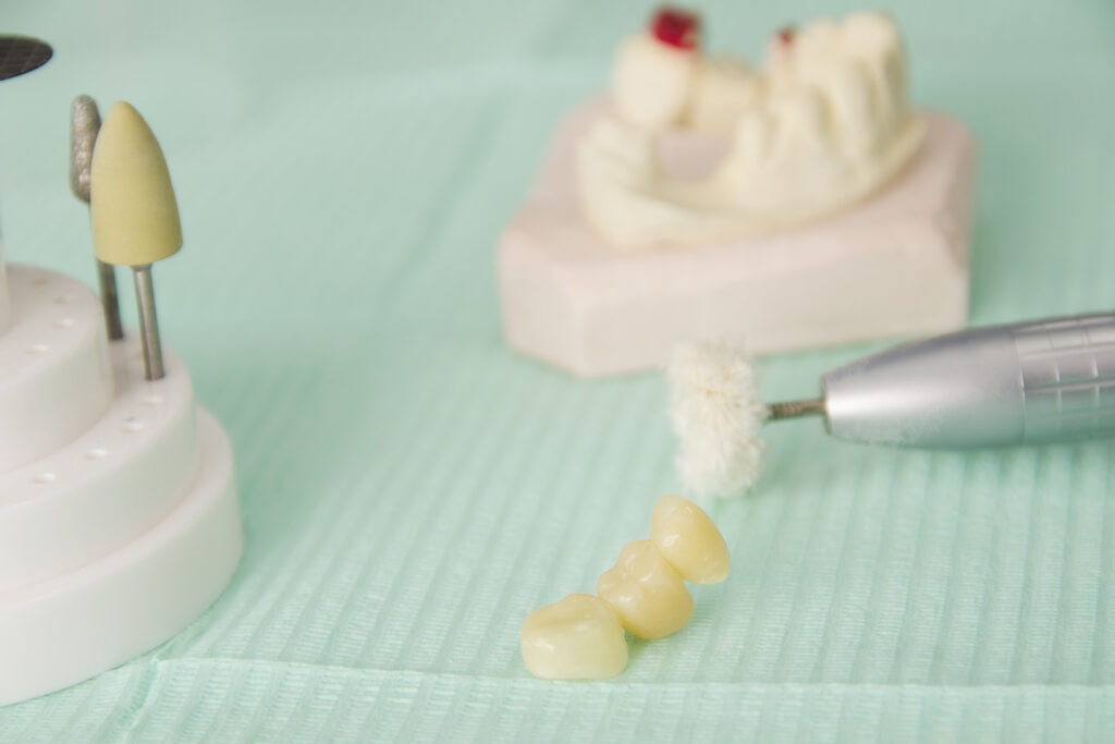 protesis | clinica dental mataro