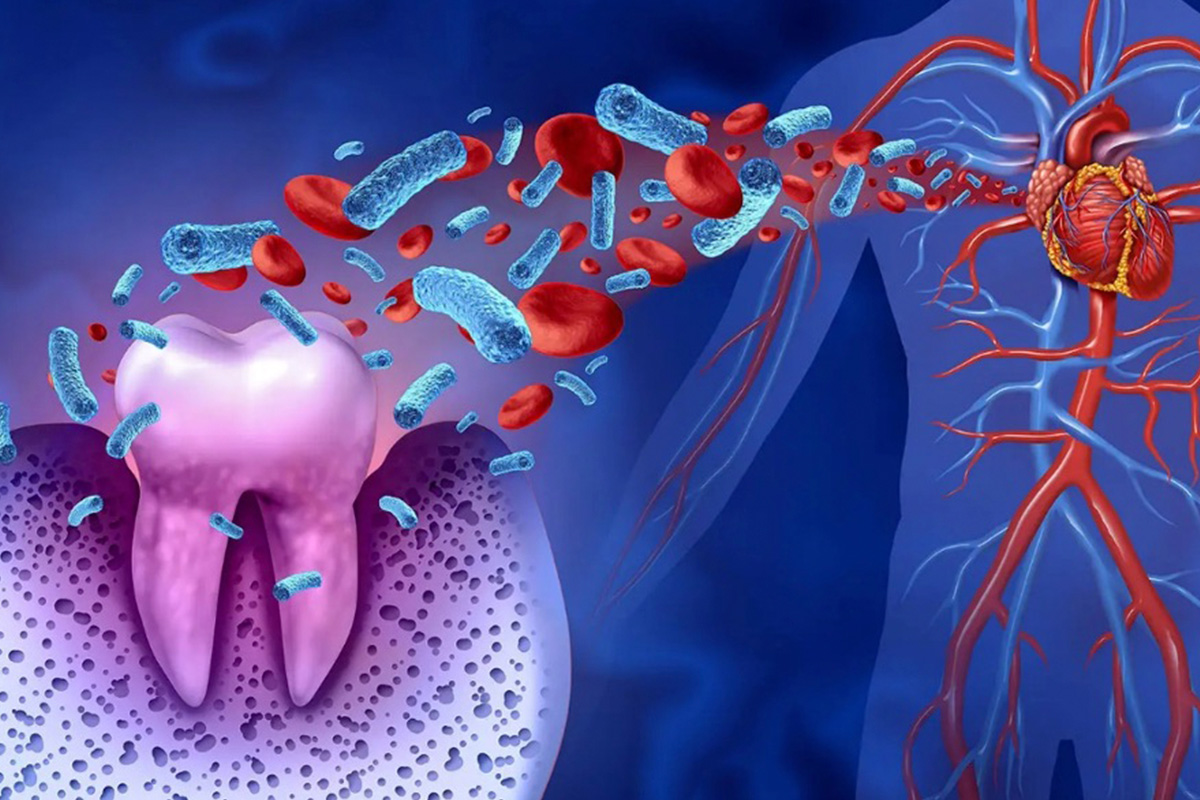 relación entre salud periodontal y salud general | Dentista en Mataró